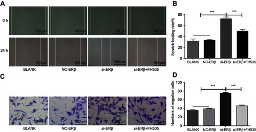 Figure 4 The migration of U2-OS cells detected by Scratch assay. (A) scratch healing under microscope (Bar =500 μm, ×4); (B) scratch healing rate; (C) migration cells under microscope (bar =200 μm, ×20); (D) number of migration cells. si-ERβ, U2-OS cells transfected with siRNA-ERβ for 48 hrs; NC-ERβ, U2-OS cells transfected with siRNA-negative control-ERβ for 48 hrs; si-ERβ + FH535, U2-OS cells transfected with siRNA-ERβ and treated with 20 μmol/L FH535 for 48 hrs; Blank, U2-OS cells without transfection and treatment. ***P<0.001.Abbreviations: ERβ, estrogen receptor β; OS, ostemsarcoma; NC, negative control; si, small interfering RNA; h, hours.