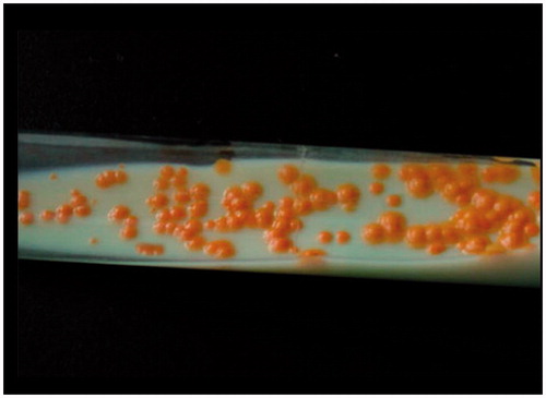Figure 3. Mycobacterium gordonae smooth, round, and pigmented yellow colonies on a Lowenstein-Jensen slant tube.