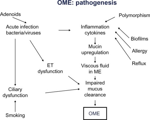 Figure 2 Pathogenesis of OME.Abbreviations: ET, eustachian tube; ME, middle ear; OME, otitis media with effusion.