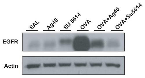 Figure 8 Effect of silver NPs and SU5614 on the protein expression of EGFR in lung tissues collected from ovalbumin-sensitized and ovalbumin-challenged mice. Western blot analysis of EGFR in total protein extracts from lung tissues. EGFR was measured 48 hours after the final challenge in saline-inhaled mice administered saline (SAL), saline-inhaled mice administered 40 mg/kg of silver NPs (Ag40) or SU5614 (SU5614), ovalbumin-inhaled mice administered saline (OVA), and ovalbumin-inhaled mice administered 40 mg/kg of silver NPs (OVA+Ag40) or SU5614 (OVA+SU5614). Blots were stripped and reprobed for actin as a loading contol.Abbreviations: EGFR, epidermal growth factor receptor; NP, nanoparticle.
