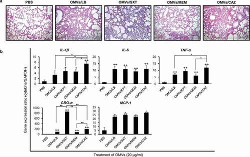 Figure 6. Inflammatory responsesin the lungs of mice administered B. cepacia OMVs. OMVs were isolated from culture supernatants of B. cepacia ATCC 25416 cultured in LB (OMVs/LB), LB with 0.5/9.5 μg/mL trimethoprim-sulfamethoxazole (OMVs/SXT), LB with 2 μg/mL meropenem (OMVs/MEM), or LB with 16 μg/mL ceftazidime (OMVs/CAZ). OMVs (20 μg of protein concentrations) were administered intratracheally, and mice were sacrificed 24 h after injection. (a) Histopathology of lungs. Lung tissues were stained by H&E. PBS was administered as a control. Magnification, 100X. (b) Pro-inflammatory response to B. cepacia OMVs in the lungs of mice. Lung tissues were removed, and gene expression was assessed by qPCR. Data are presented as the mean ± SD of five mice. +P < 0.05, ++P < 0.01 compared to PBS control group.*P < 0.05, **P < 0.01compared to OMVs/CAZ or OMVs/SXT.