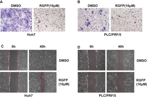 Figure 2 RGFP966 suppresses cell migration of HCC cells. (A) and (B), 5x10Citation4 Huh7 and PLC/PRL/5 cells were plated into transwell chamber with treatment of RGFP966 (RGFP,10μM) or vehicle. After 40 hrs, the invaded cells were stained, and representative images were photographed. (C) and (D), After a linear wound was generated, Huh7 and PLC/PRL/5 cells were treated with RGFP966 (RGFP, 10μM) or vehicle. After 40 hrs, representative images were photographed.