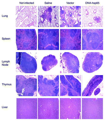 Figure 3. Histopathological analysis of mice infected with M. tuberculosis and treated or not with DNA-hsp65 immunotherapy. Sections of lung, spleen, lymph node, thymus, and liver were obtained from not infected, saline, vector, and DNA-hsp65 groups. The lung samples presented an active inflammatory process with granuloma-like structures across the tissue in samples from saline and vector injected groups. These lesions were less prominent and smaller in DNA-hsp65-treated animals. In contrast, samples from all of the infected groups presented a slight lymphoid hyperplasia in spleen, lymph node, thymus, and liver. The figure shows the results at 120 d after infection. Similar findings were observed at day 70. Tissue was fixed with 10% buffered formalin, and 5 μm sections were stained with hematoxylin and eosin as described in the text. Magnification panels, 100 ×.