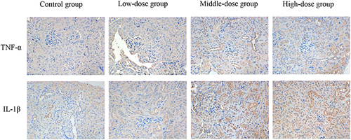 Figure 12 Expression of TNF-α and IL-1β detected via immunohistochemistry in the kidney sections at 120h (magnification ×400). The positive color was tan.