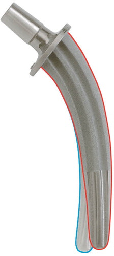 Figure 1. The collum femoris-preserving (CFP) stem is available with two different curvatures in order to accommodate variations in femoral anatomy.