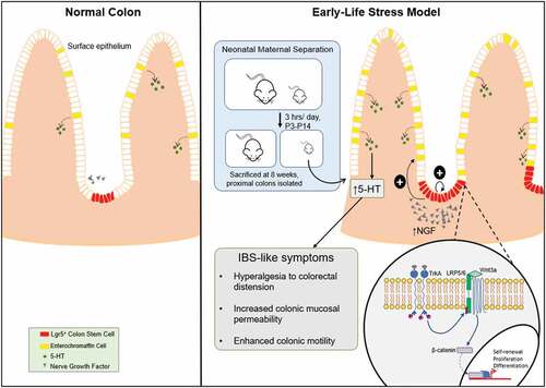 Figure 1. Our proposed model of early life stress-induced IBS.