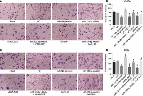 Figure 9. Transwell assay reveals the upregulation of miR-129-5p restrains CC cell invasion (× 100).Note: A, cell invasion images of C-33A cell line after transfection; B, the histogram comparing the number of invasive cells in C-33A cell line after transfection; C. cell invasion images of Hela cell line after transfection; D, the histogram comparing the number of invasive cells in Hela cell line after transfection; NC, negative control; miR-129-5p, microRNA-129-5p; ZIC2, zinc finger protein of the cerebellum 2; *, p < 0.05 compared with the blank and NC groups; #, p < 0.05 compared with the miR-129-5p inhibitor group.