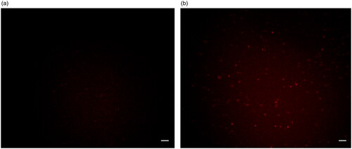Figure 9. Fluorescence image of HepG-2 treated with (a) free ICG and (b) Ag-Au-ICG in 1% Intralipid for 2 h. Scale bar, 50 µm.