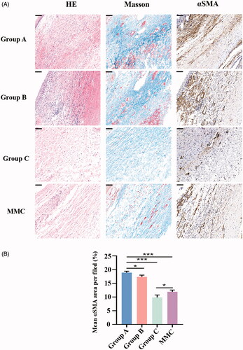 Figure 5. (A) Histologic features of each group 28 days after GFS. Sections were stained with HE, Masson’s trichrome and α-smooth muscle action immunohistochemistry. Magnification: ×300, Scale bar: 100um. (B) Graph shows the mean αSMA area per filed in group A, B, C and MMC. *p < .05, ***p < .001.