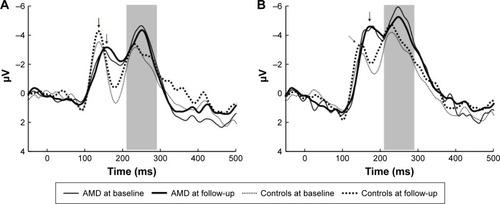 Figure 2 Difference waveforms (target minus standard) in 2 electrode locations, Oz (A) and PO8 (B) in AMD patients and controls.