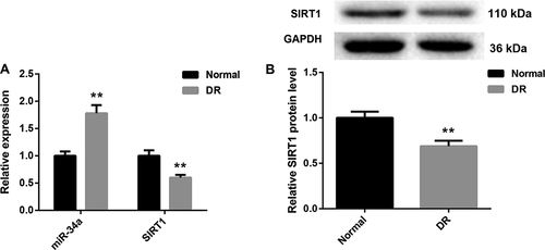 Figure 1. MiR-34a is up-regulated and SIRT1 is down-regulated in the retinal tissues of DR rats