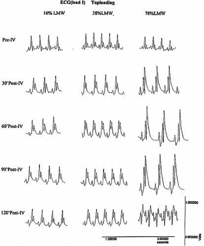 Figure 6 Changes in electrocardiogram (ECG) after injection of 1/6 toploading with PolyHb containing 16%, 38% and 78% of tetramers at 30, 60, 90, and 120 minutes. Pre-IV: before intravenous injection; Post-IV: after intravenous injection. Preliminary study shows that similar toploading using PolyHb with 0.4% tetramers did not result in any changes.