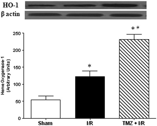 Figure 6. Representative western blotting of HO-1. The β-actin was used as a loading control. One representative blot of six independent experiments is shown at the top whereas densitometric analysis is shown at the bottom. Results are expressed as mean ± SEM for six independent experiments. Note: *p < 0.05 versus Sham group. #p < 0.05 versus I/R group.