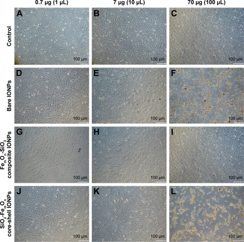 Figure 3 Bright-field microscopy of human umbilical vein endothelial cells with 50× magnification 48 h after incubating with IONPs at three different doses; 0.7, 7.0, and 70.0 μg.Notes: The images are representative of at least three independent experiments. (A–C) controls; (D–F) bare IONPs; (G–I) FemOn-SiO2 composite IONPs; and (J–L) SiO2-FemOn core-shell IONPs.Abbreviation: IONPs, magnetic iron oxide nanoparticles.