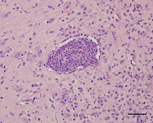 Figure 2.  Cerebrum (mesopallium), 4-week-old chicken, experimentally infected with Turkey ND strain. 10 d.p.i. Marked infiltration of lymphocytes and plasma cells in and around the vascular wall. Haematoxylin and eosin. Bar=50 µm.