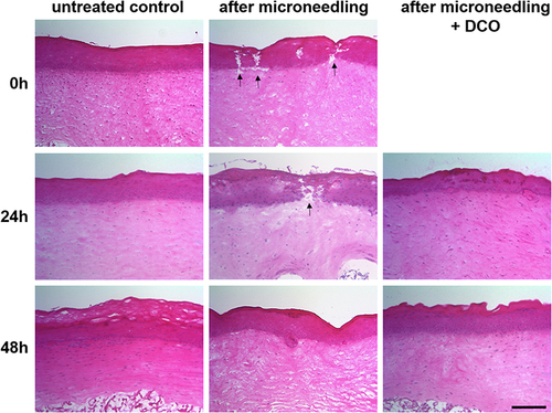 Figure 1 Histological analysis of micro-needling-treated 3D skin models. Upper row shows hematoxylin and eosin stainings of untreated controls and skin models immediately after micro-needling treatment (0 h). The middle row shows untreated controls, micro-needling-treated models, and models that were additionally post-treated with DCO, 24 h after treatment. The bottom row shows the corresponding models 48 h after treatment. Shown are representative images from four independent experiments. h = hours. Scale bar: 200 µm. The black arrows indicate the lesions.