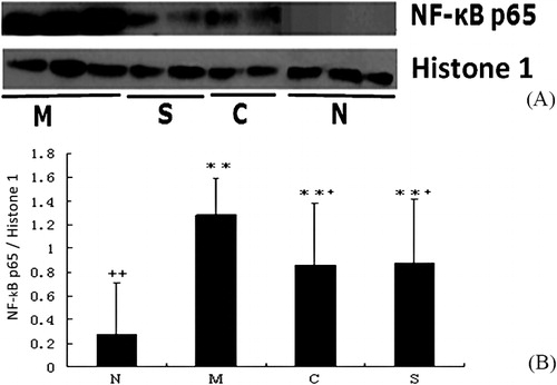 Figures 4. Expression of NF-κB p65 measured by Western blotting in different experimental groups. The treatment and supplementation of the mice (n = 10/group) as described above (Figure 1). After blood collection, all the mice were sacrificed to collect colon. The tissue lysate was prepared for Western blotting analysis. Data shown are the representative image (A) and means ± SD (n = 10/group) of the relative expression of NF-κB p65 normalized to Histone 1 (B). N, healthy control group; M, model of UC control group; S, SASP group; C, CGMP group. **P < 0.01 between the healthy control and other groups. +P < 0.05; ++P < 0.01 between the UC control and other groups.