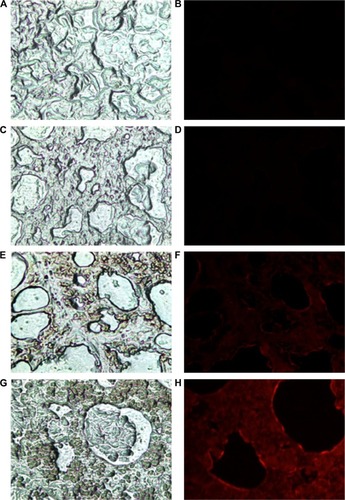 Figure 4 Fluorescence microscopy images of lung fractions of rats exposed to gold nanoparticles and/or static magnetic fields.Notes: Light microscopy (A) and fluorescence microscopy (B) of lung sections of control rats. Light microscopy (C) and fluorescence microscopy (D) of lung sections of SMF-exposed rats. Light microscopy (E) and fluorescence microscopy (F) of lung sections of GNPs-treated rats. Light microscopy (G) and fluorescence microscopy (H) of lung sections of coexposed rats to gold nanoparticles and static magnetic field. ×100 magnification.Abbreviations: GNPs, gold nanoparticles; SMF, static magnetic field.