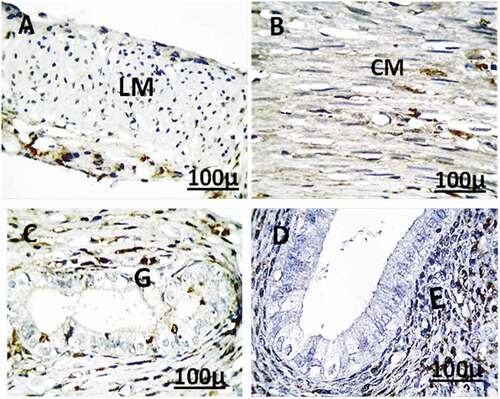 Figure 12. Immunohistochemistry showing caspase-3 streptavidin-biotin- peroxidase staining method in the uterus of control adult female rats showing normal expression of immune stain caspase-3. LM = Longitudinal Muscle, CM = Circular Muscle, E = endometrium, G = Gland.