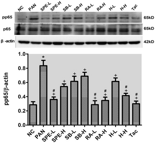 Figure 6. The effects of SPE and its monomers on the level of pp65 in PAN-treated podocytes. NC, untreated control; PAN, model; SPE-L, 158 g/mL; SPE-H, 316 g/mL; SB-L, 8.5 g/mL; SB-H, 17 g/mL group; RA-L, 25 g/mL; RA-H, 50 g/mL; H-L, SalB + RA (8.5 + 25 g/mL) combined; H-H, SalB + RA (17 + 50 g/mL) combined; Tac. positive control. Note: *p < .05 vs. NC; +p < .05 vs. PAN; #p > .05 vs. NC