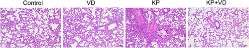 Figure 2 Vitamin D attenuates pathological lung injury in Klebsiella pneumoniae-induced rats. H&E staining was used to detect pathological changes in the lung tissues of rats in the Control, VD, KP, and KP+VD groups.