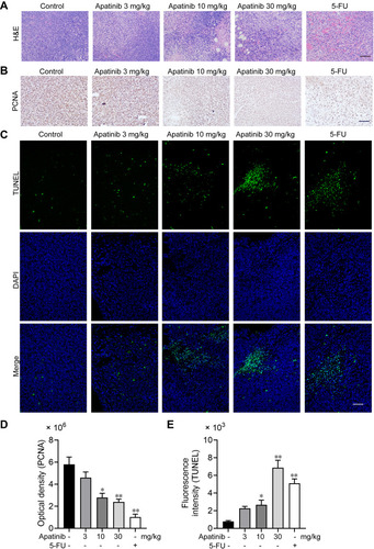 Figure 7 Apatinib promoted tumor cell apoptosis and inhibited the proliferation of tumor cells in vivo. (A) The tumor tissues of the mice were fixed and sliced. The morphology and density of the tumor cells of each group were observed by H&E staining. (B and D) Immunohistochemistry staining and quantitative analysis of PCNA in tumor tissues. (C and E) TUNEL staining and quantitative analysis of apoptotic tumor cells in each group. Scale bar 100 μm, *p<0.05, **p<0.01 vs control group.