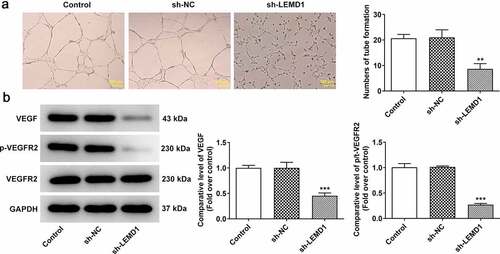 Figure 3. LEMD1 knockdown suppresses angiogenesis in colon cancer. (a) Tube formation assay detected angiogenesis. Magnification, x4. (b) The protein levels of VEGF and p-VEGFR2/VEGFR2 were determined by western blot. **P < 0.01, ***P < 0.001 vs. sh-NC.