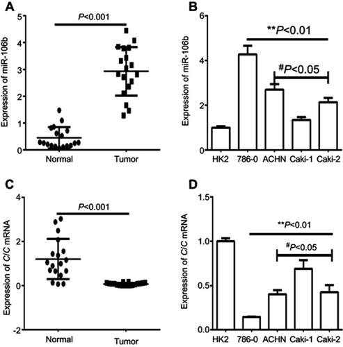 Figure 1 Expression of miR-106b and CIC in RCC tissues and cell lines. Notes: (A) qRT-PCR analysis showed the expression of miR-106 in the RCC tissues (tumor) and the adjacent non-tumor tissues (normal) in patient samples (n=20). (B) qRT-PCR analysis of expression of miR-106b in RCC cancer cell lines (786–0, ACHN, Caki-1, Caki-2) and in normal renal tubules epithelium cell HK-2. (C) qRT-PCR analysis showed the expression of CIC in the RCC tissues (tumor) and the adjacent non-tumor tissues (normal) in patient samples (n=20). (D) qRT-PCR analysis of expression of CIC in RCC cancer cell lines (786–0, ACHN, Caki-1, Caki-2) and in normal renal tubules epithelium cell HK-2. **P<0.01, vs HK-2 cell; #P<0.05, vs 786-O cell.Abbreviations: CIC, capicua homology protein; RCC, renal call carvinoma cancer.