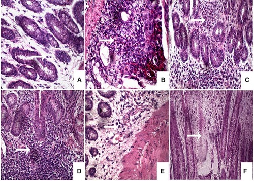 Figure 7 Microphotographs illustrating the type of leukocytes infiltration in rabbit colonic tissues.