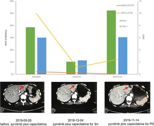 Figure 3 The relationship between gene dynamics and efficacy. The red arrows indicate the metastatic tumor.