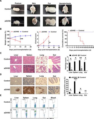 Figure 1 Induced aGVHD model in NPG mice. (A) Representative clinical manifestations including hunched posture, ruffed fur, damaged skin, and hematochezia in the aGVHD mouse model. (B) Measurement of weight change, clinical score, and survival time at different time points with those two groups. The weight loss rate in aGVHD group is faster than in the control group, the clinical score of aGVHD was higher than that of the control group, the survival time of the control group was also significantly longer than that of the aGVHD group. *p < 0.05 and **p < 0.01. (C) Representative histology of target organs, including the liver, spleen, lung and gut, showed inflammatory cell infiltration and tissue damage in aGVHD group. 400×. *p < 0.05 and **p < 0.01. (D) Representative immunohistochemistry of target organs. Human CD45+ cells were detected by immunohistochemistry in these target organs. 400×. *p < 0.05 and ***p < 0.001. (E) Human CD3+ T cells were not detected by flow cytometry in the control group. Human CD3+ T cells from each target organ were detected by flow cytometry in the aGVHD group.