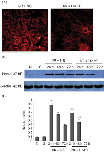 Figure 5. The expression of hes-1 protein (A–C): (A) The expression of hes-1 protein in the kidney at 24 h following IRI by immunohistochemistry staining (original magnification ×400). Renal IRI induced the increase of hes-1 protein expression in the renal tubules. DAPT treatment reduced the expression of hes-1 protein. (B) Immunoblot analysis of hes-1 protein at 24 h, 48 h, and 72 h of post-reperfusion, respectively. (C) The density of band was quantified. Values presented are ratios of hes-1 to β-actin, which was used as an equal protein loading marker. Results are presented as mean ± SEM (n = 5), *p < 0.05 versus sham group at the same time point. **p < 0.05 versus respective IR + NS at the same time point.