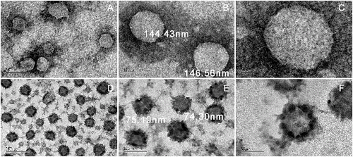 Figure 3. Transmission electron microscopy analysis of ULs and LTTOs. A–C, ULs; D–F, LTTOs.