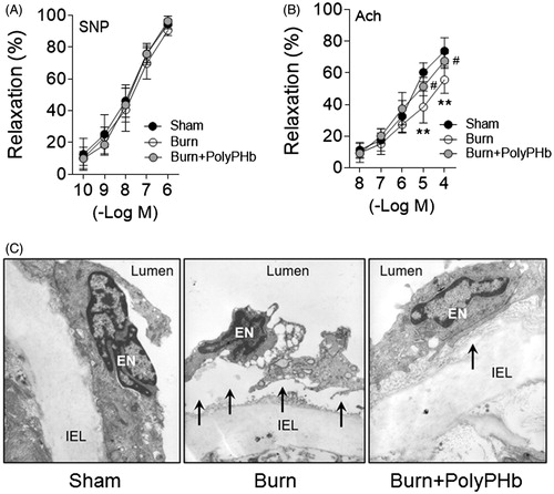 Figure 4. PolyPHb ameliorated endothelial damage caused by severe burn. (A) The SNP-induced endothelium-independent relaxation and Ach-induced endothelium-dependent relaxation of aorta. Values are presented as mean ± SD (n = 5 per group). **p < .01 vs. the Sham group; #p < .05 vs. the Burn group. (B) Representative transmission electron microscopy images of the ultrastructure of the aortic endothelium (n = 3). (C) Original magnification ×10,000. Black arrows indicate endothelial cell lifting and separation from the IEL. SNP: sodium nitroprusside; Ach: acetylcholine; IEL indicates internal elastic lamina.