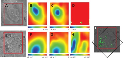 Figure 6 Chemical imaging using Fourier transform infrared spectroscopy on single cells. (A, E) Light microscope images of a control cell (square dimension, 42×63 μm) and a cell treated with nanoparticles, respectively. (E) Box delineates the area analyzed by Fourier transform infrared spectroscopy (square dimension, 42×63 μm). Chemical imaging for the presence of lipids, proteins (amide I), and poly-lactide-co-glycolide are shown in a control cell (B–D) and in a cell incubated with poly-lactide-co-glycolide iron oxides nanoparticles (F–H). (I) Merge image of the visible light and Fe map from X-ray fluorescence analyses of the cell (E), revealing the iron oxide presence. The red box indicates the area analyzed by Fourier transform infrared spectroscopy, whereas the black one indicates the X-ray fluorescence area.