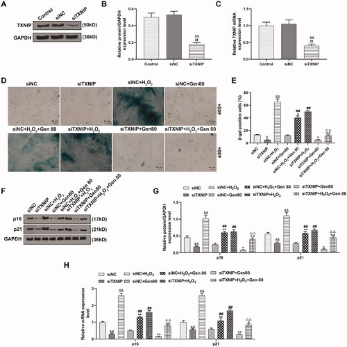 Figure 9. Silencing of TXNIP enhanced the effect of Gen on the senescence and senescence-related proteins expression in H2O2-treated HUVECs. (A–C) After transfection of siTXNIP, the expression of TXNIP was detected by qRT-PCR and western blot. (D, E) After transfection of siTXNIP, H2O2-induced HUVEC senescence after 80 μg/mL Gen treatment was detected by β-galactosidase staining. (F–H) After transfection of siTXNIP, the relative mRNA expression of p16 and p21 in H2O2-treated HUVECs under 80 μg/mL Gen treatment was determined by qRT-PCR and western blot.