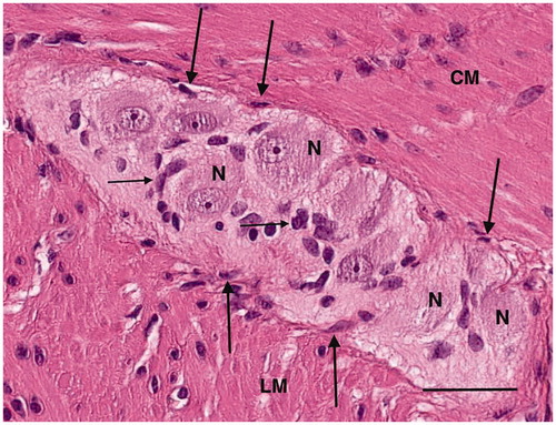 Figure 7. Colon, myenteric ganglion. High magnification light microscopy. Several neurons (N), glial cells (thin arrows) and spindle-shaped cells (thick arrows) between the ganglion and the surrounding muscle. CM: circular muscle; LM: longitudinal muscle; hematoxylin and eosin. Bar: 25 μm.