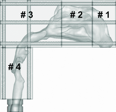 FIG. 1 The side view of a 5-year-old child's nasal replica with four regions: anterior (#1), turbinate (#2), posterior (#3), and laryngeal and tracheal (#4) regions.