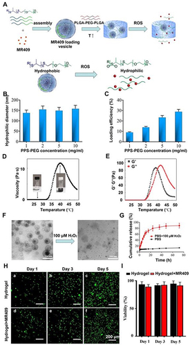 Figure 2 A new injectable thermosensitive hydrogel with ROS-sensitive MR409-loaded vesicles demonstrates sustained controlled release and biocompatibility. (A) Schematic illustration of the thermosensitive hydrogel loaded with ROS-responsive PPS-PEG vesicles for controlled release of MR409. (B) Hydrodynamic diameters and (C) MR409-loading efficiencies of PPS-PEG vesicles. (D) Viscosity of the PLGA-PEG-PLGA solution containing MR409-loaded vesicles as a function of temperature. (E) G’ and G” of the PLGA-PEG-PLGA solution containing MR409-loaded vesicles as a function of temperature. (F) Change in the morphology of MR409-loaded vesicles in the presence of external H2O2 (100 µM). (G) Cumulative release of MR409 from PPS-PEG vesicles or hydrogel containing vesicles in the presence of 100 µM H2O2. (H and I) Images of live/dead cell staining (H) and quantitation (I) of rat NP cells cultured with hydrogel confirming good biocompatibility. Reprinted from Zheng Q, Shen H, Tong Z, et al. A thermosensitive, reactive oxygen species-responsive, MR409-encapsulated hydrogel ameliorates disc degeneration in rats by inhibiting the secretory autophagy pathway. Theranostics. 2021;11(1):147–163. Creative Commons.Citation85