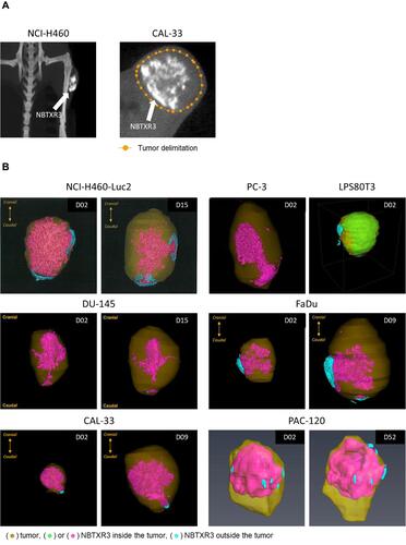 Figure 3 After intratumoral injection, NBTXR3 distributes and remains in the tumor. (A) Thanks to its composition, NBTXR3 is easily observable in the tumor by µCT (white areas indicated by the arrows). (B) 3D representation of the of NBTXR3 nanoparticles distribution within tumor tissues of models NCI-H460-Luc2, PC-3 and LPS80T3 (upper panel), DU-145, FaDu (middle panel), CAL-33 and PAC-120 (lower panel), after µCT analysis. Indicated day corresponds to time post-intratumoral injection (D01).