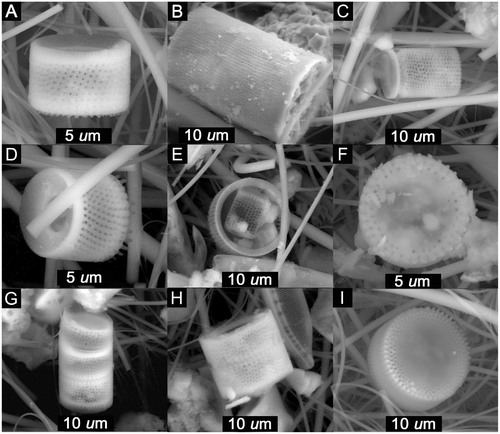 FIGURE 2. Aulacoseira valves (centric diatoms) observed in (A–C) QSD1, (D–F) QSD2, and (G–I) QSD3. Parts A, D, and F–I are Aulacoseira alpigena; others are Aulacoseira sp.