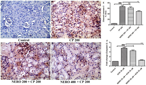 Figure 4. (A-D) Showing the effect of nerolidol 200 and 400 mg/kg, p.o against cyclophosphamide-induced markers of apoptosis (cleaved caspase-3) in the renal tissue, whereas figure E represents the semi-quantitative analysis of cleaved caspase level estimated in the in vivo study. Figure F represents the expression of caspase-3 from the in vitro study. One-way ANOVA i.e., tukey’s multiple comparison test was used for statistical analysis. (400 × magnification).