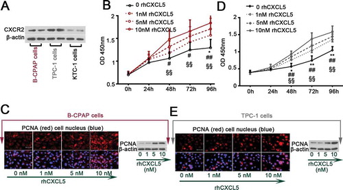 Figure 1. Exogenous rhCXCL5 promotes PTC cell proliferation (a) The basal expression of CXCR2 in B-CPAP, TPC-1 and KTC-1 cells were determined with Western blot analysis. (b-c) B-CPAP cells and (d-e) TPC-1 cells were treated with 1, 5, 10 nM rhCXCL5 protein for 24, 48, 72 or 96 hrs before CCK-8 (n = 5), immunofluorescence and Western blot assays using anti-PCNA antibody (bars, 50 μm; 48 hrs post rhCXCL5 treatment). **P < 0.01 and *P < 0.05 (1 nM rhCXCL5 versus Control), ##P < 0.01 and #P < 0.05 (5 nM rhCXCL5 versus Control), §§P < 0.01 (10 nM rhCXCL5 versus Control). PTC, papillary thyroid carcinoma; rhCXCL5, recombinant human C-X-C motif chemokine ligand 5; CXCR2, C-X-C motif chemokine receptor 2; PCNA, proliferating cell nuclear antigen.