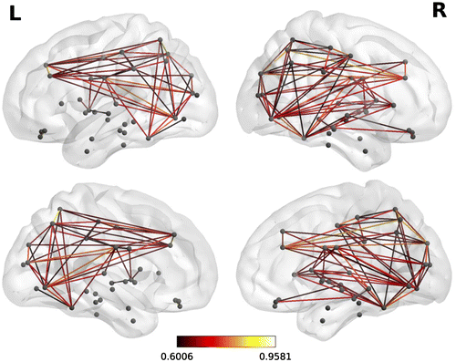 Figure 2. A representative functional brain network from the same participant shown in Figure 1 during the multi-sentence reading comprehension task.