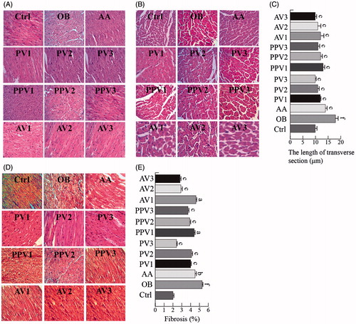 Figure 2. FVs attenuate cardiac histological abnormalities, hypertrophy and fibrosis in the hearts of HFD-fed rats. (A,B) Representative images for the hematoxylin-eosin (H&E) staining in the formalin-fixed myocardial tissues (400× amplification). (C) Quantitative data of myocyte cross-section length of 100 cells chosen from different visual scopes of three samples per group in myocardial transverse H&E staining are shown. (D) Representative images for the Masson staining in the formalin-fixed myocardial tissues (400× amplification). (E) Quantitative analysis of fibrotic area (Masson trichrome-stained area in light blue normalized to total myocardial area; n = 3 rats/group). Values are statistically different at: ap < .05, bp < .01, cp < .001, when compared with OB group values. Values are statistically different at: dp < .05, ep < .01, fp < .001, when compared with Ctrl group values.