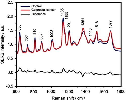 Figure S3 The mean surface-enhanced Raman scattering (SERS) spectra of serum from controls and colorectal cancer patients and their difference. The SERS spectra were acquired by focusing a 532 nm laser (10 mW) on the samples for 40 s. The SERS spectra were mean normalized and for each spectrum, two measurements were averaged