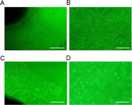 Figure 1. Culture of HGFs and HGECs in vitro. (A) Primary culture of HGFs, the cells had a clear morphology, and the nucleus showed an elliptical shape; Scale bar = 500 µm. (B) Subculture of HGFs, the cells gradually tend to have consistent morphology in fusiform shape appearing fibroblast-like phenotype; Scale bar = 200 µm. (C) Primary culture of HGECs, the cells grew radially around the tissue block, and showed an oblate shape appearing fibroblast-like phenotype; Scale bar = 500 µm. (D) Subculture HGECs, the cells appeared in epithelioid shape, and presented a “paving stone” like cluster aggregation; Scale bar = 200 µm.
