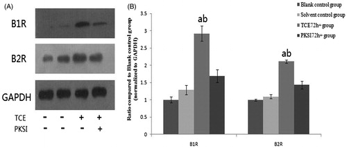 Figure 7. Western blots of kidney B1R and B2R kinin receptors. (A) B1R and B2R protein expression in the kidney detected by Western blot. (B) Quantitative data; results are expressed as ratio of B1R and B2R vs GAPDH. Data shown are means ± SD. aValue significantly different vs solvent control (p < 0.05). bValue significantly different vs corresponding PKSI + group (p < 0.05).
