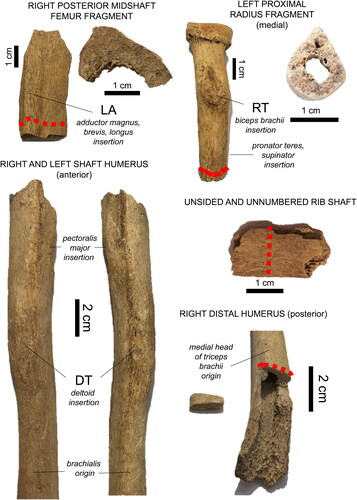 Figure 3. Bone fragments examined in the present case study. The red dashed lines indicate sampling regions for histology, with the extracted samples shown on the right (femur, radius) and left (right distal humerus). RT: radial tuberosity, DT: deltoid tuberosity, LA: linea aspera. Muscle insertions and origin are italicized.