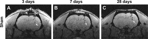 Figure S2 MRI of sham animals.Notes: Animals injected with buffer, as opposed to cells, were also scanned using 3D gradient-echo MRI. The imaging protocol and parameters were identical to those mentioned in the main paper. As reported in the literature, at all the three time points (3, 7, and 28 days post-transplantation) assessed, signal dropout was seen corresponding to the needle track area (arrows in [A–C]).Abbreviation: MRI, magnetic resonance imaging.